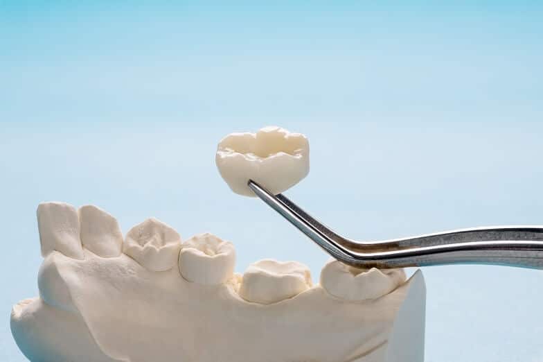 Prikaz zubne krunice i modela zubi