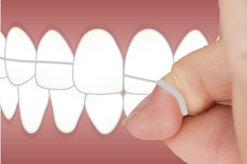 Ilustracija čišćenja zubi zubnim koncem